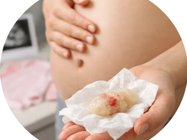 Losing the Mucus Plug: Everything You Need to Know