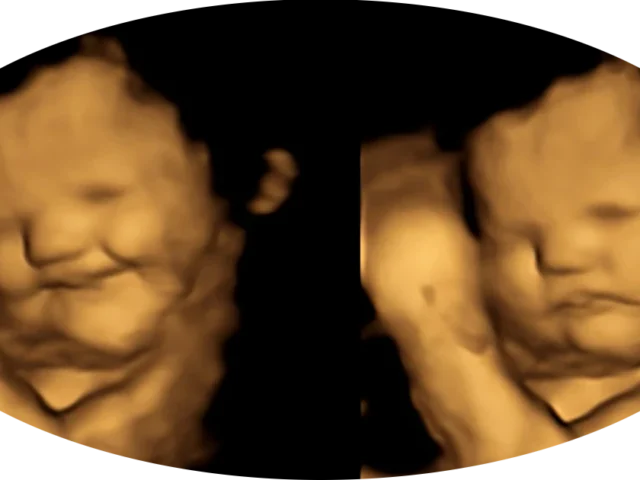 Can babies cry and laugh in the womb?