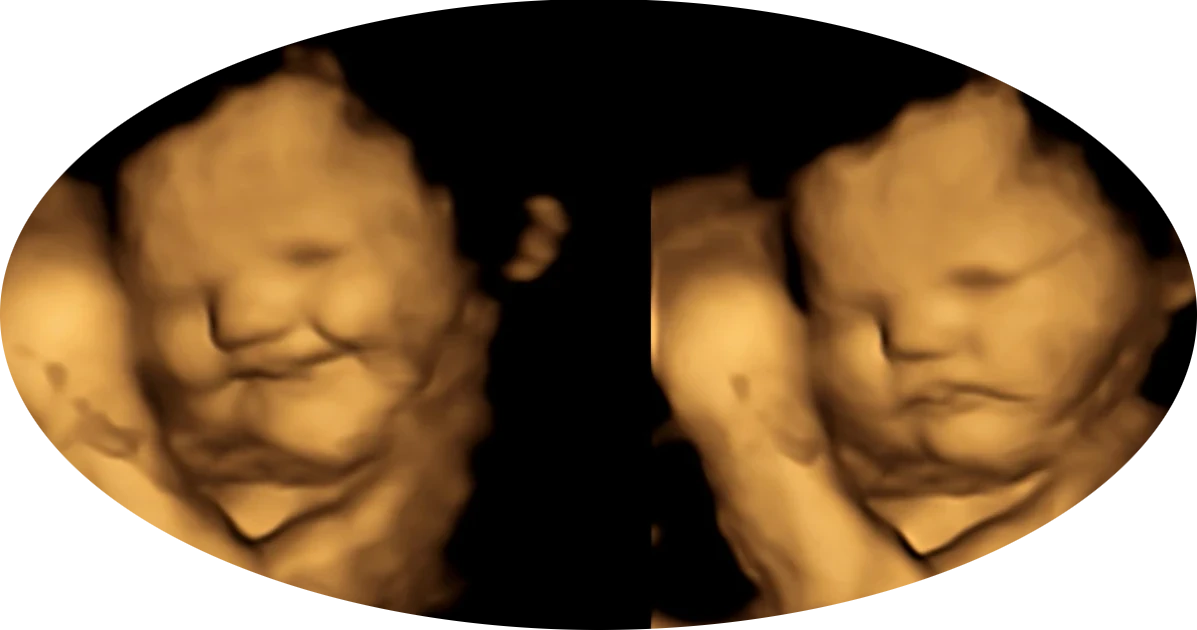 emotions in the womb